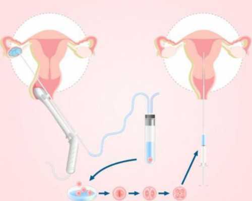 2024年大连做试管婴儿能包生男孩的医院名单