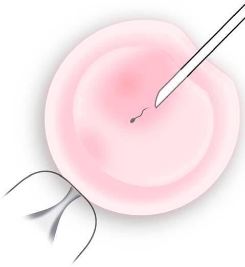 大连三代供卵试管婴儿医院排名