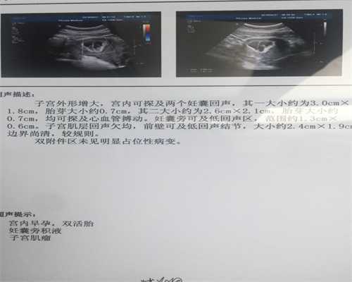 大连三代供卵试管婴儿医院排名？附大连各医院试管婴儿成功率明细？