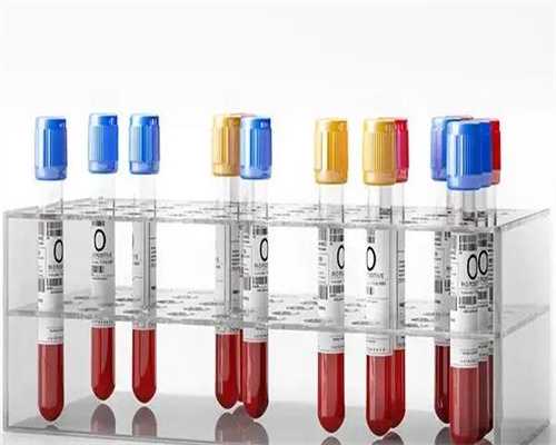 香港验血查男女都有哪些机构，这下要素需要掌,香港验血电话通知