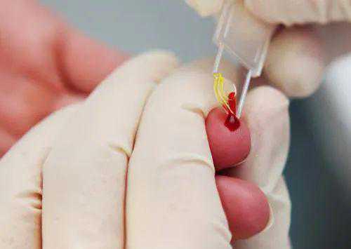 香港怀孕验血报告单18个VE_去香港验血必须学会这,香港验血中介在哪里