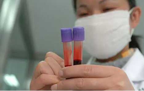 香港验血报告单如何看，靠谱的香港验血中介,孕6.5周香港验血验的出吗