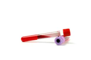 怎么去香港鉴定性别？推荐既快又准确的权威验,香港邮寄验血寄多少血