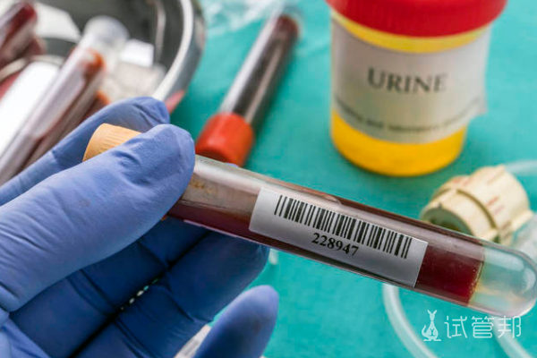 珠海借卵生子——供卵试管行业里的领先技术,香港验血5周跟7周验血一样吗