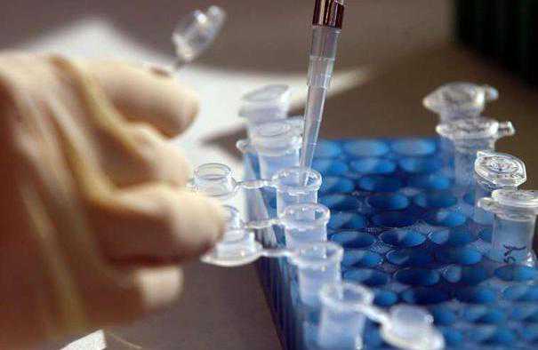 香港验血报告结果没有验出y,香港验血判定性别的时刻是多少,判定性别真的靠谱