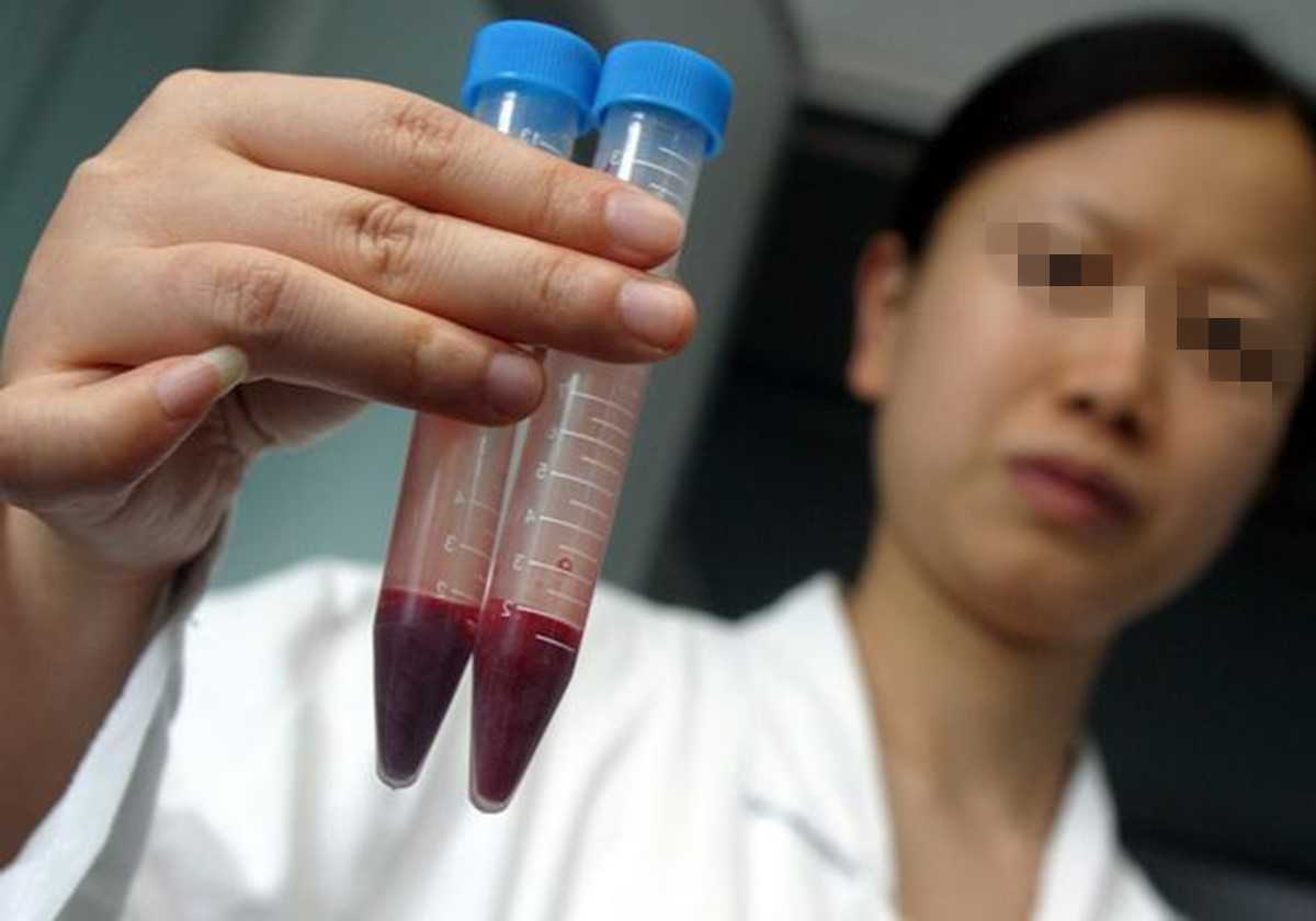 香港验血条件_香港验血的攻略整合如下,香港验血几个y就是男孩还是女孩