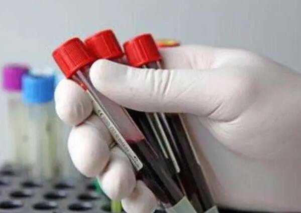 怀孕半年后可以香港验血,香港验血测男女准吗,检测条件及流程!