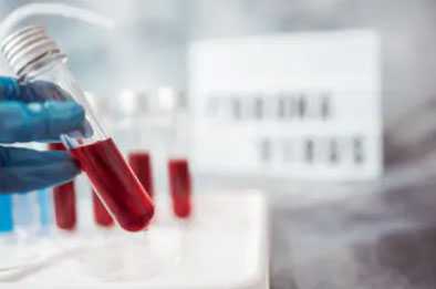 生男生女孕期症状验证，去了香港百高基因验血结果..,香港邮寄血样验血