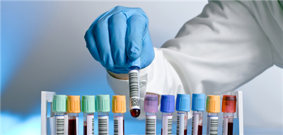 寄血验男女可靠吗？(给想去的姐妹一个参考)!,深圳代检香港八周验血