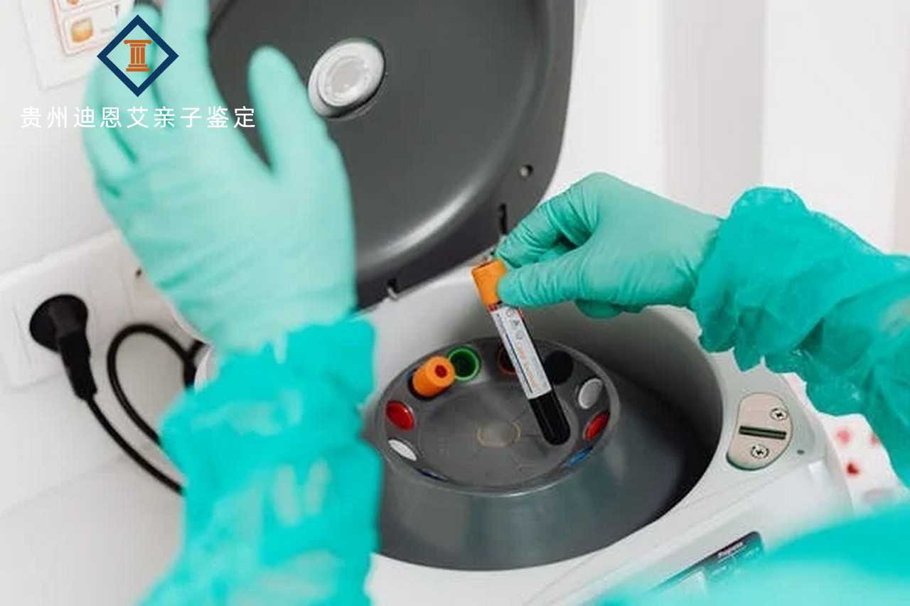 香港验血测男女有没有验错的——验血一次花销,香港验血鉴定性别的机构