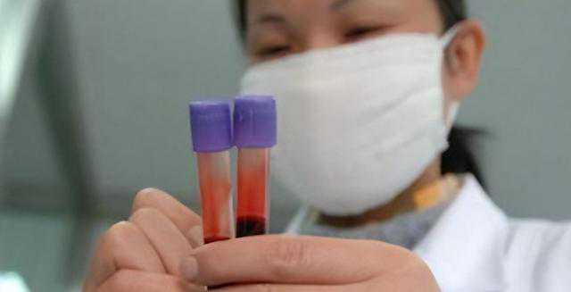 香港验血测男妇准确率高吗？验血顾问在线全程,5周可以香港验血吗