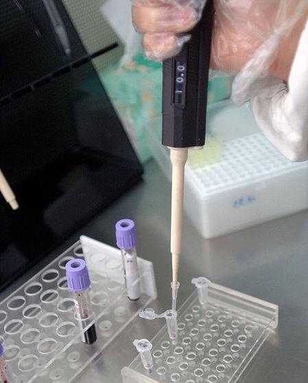 香港验血鉴定男女准吗 需要多少钱,检查怀孕是验血还是做b超