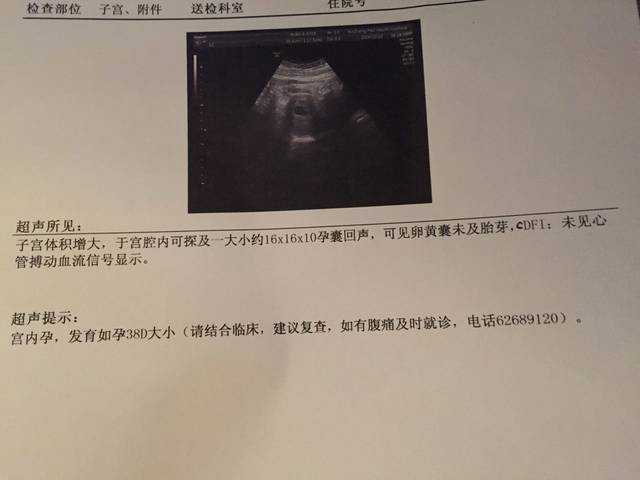 香港验血中介可靠吗  总结下香港鉴定性别攻略,香港胎儿验血鉴别多少钱