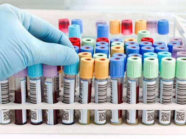 香港到哪验血准不准,验血查男女准确率多高,香港怀孕7周验血