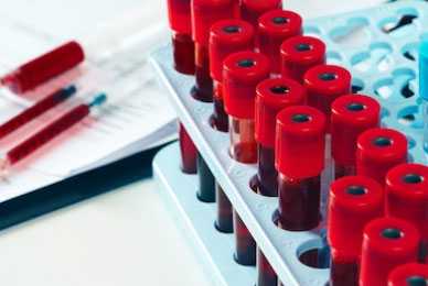 香港验血如何预约正规途径_验血准确率(价格、攻,香港孕妇验血费用