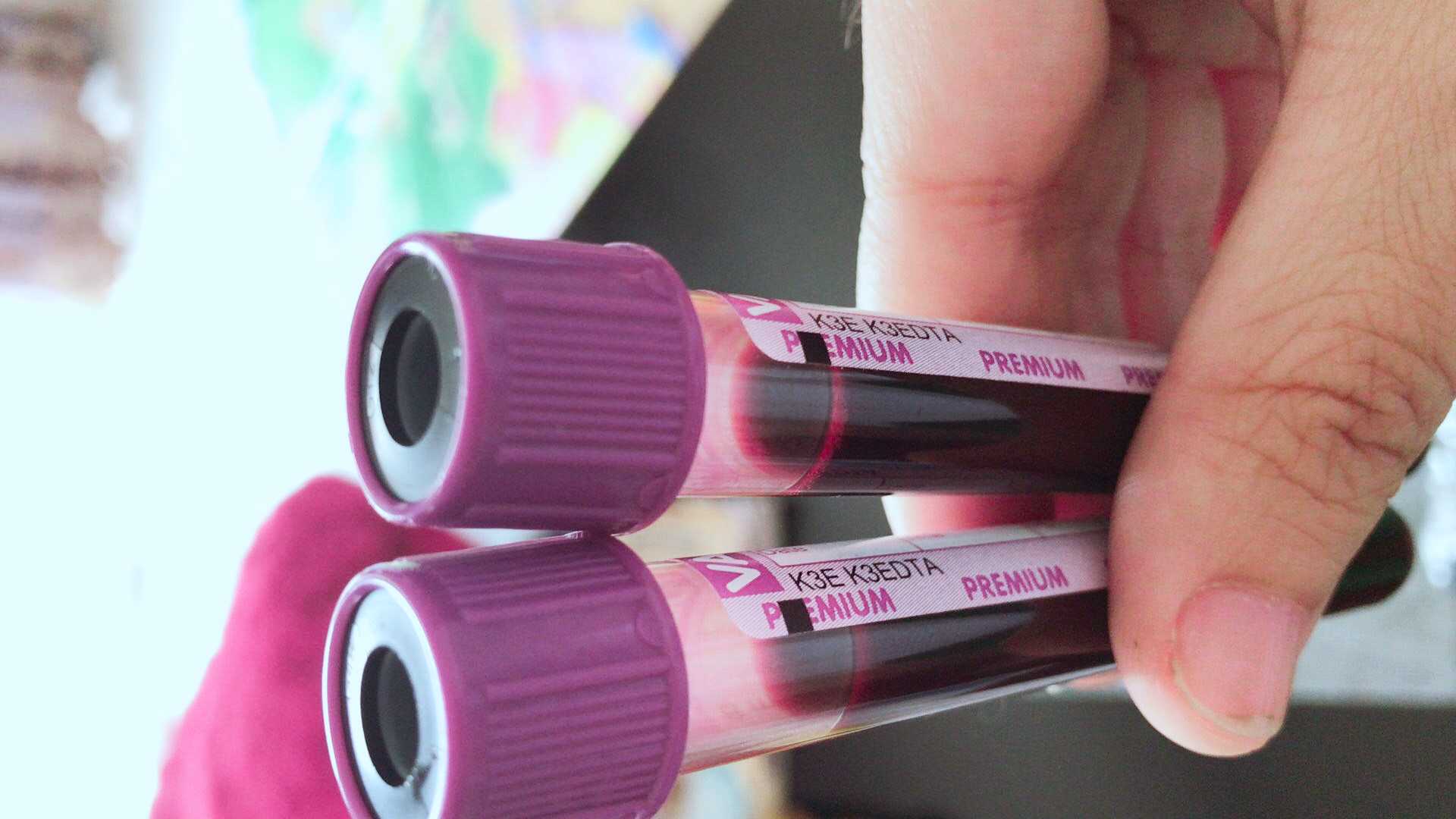 怀孕去香港验血要多少天才有结果,香港验血应该注意什么地方?早知道早准备