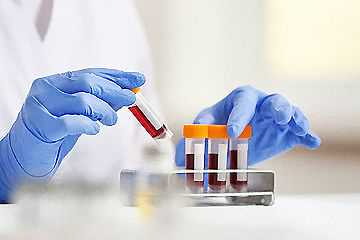 7周香港验血男孩却生了女孩_点评整个验血流程,香港验血预约的个人资料